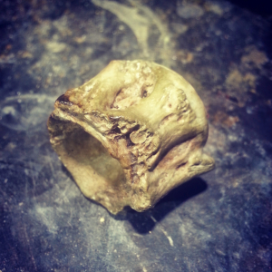 Cast concrete vertebrae 